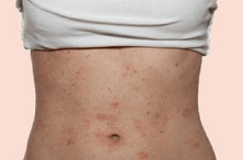 Xử Trí Như Thế Nào Khi Sử Dụng Máy Massage Bụng Bị Ngứa?